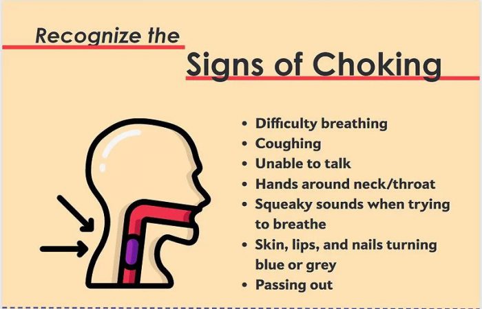 Choking Prevention poster